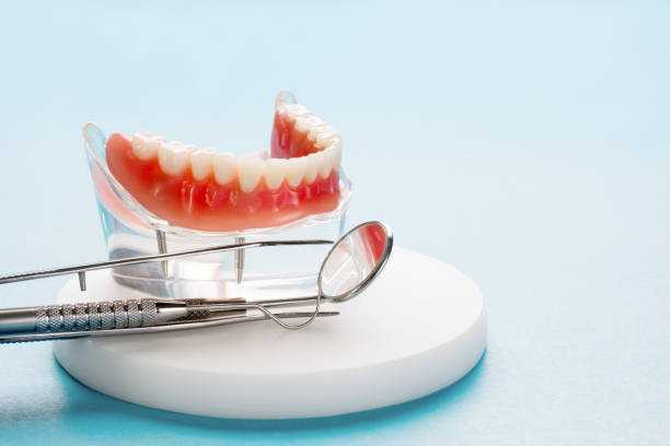 Dental Inlays and Onlays in Hudson, NC